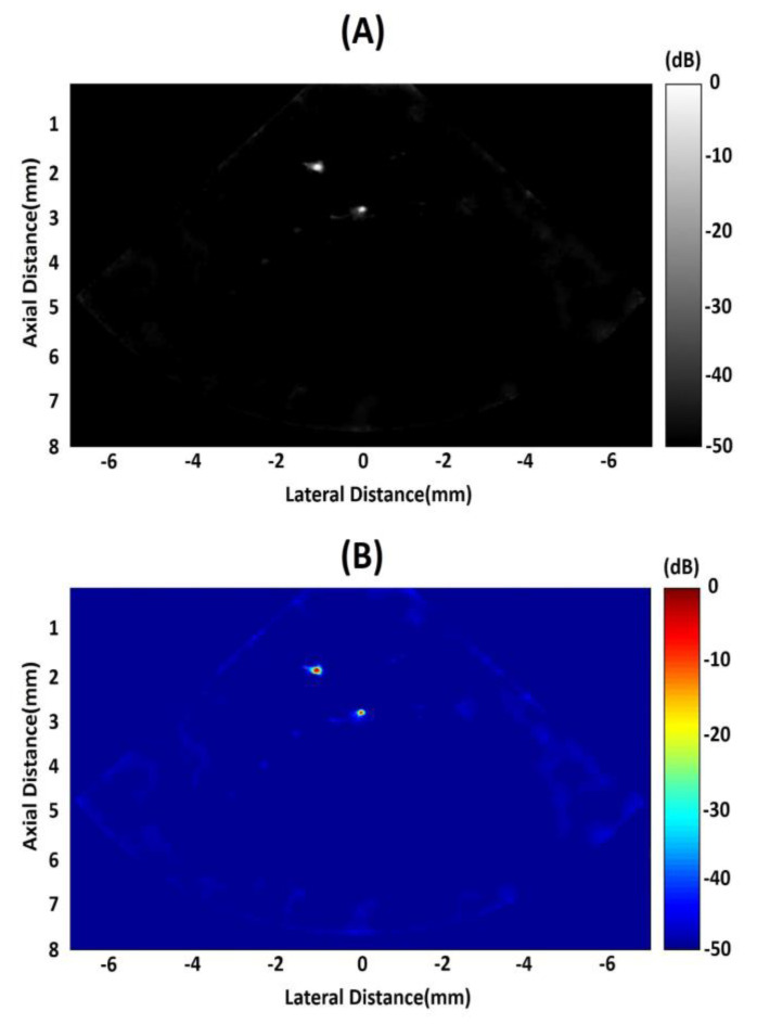 Изображение проволочного фантома, полученное single-crystal phased array