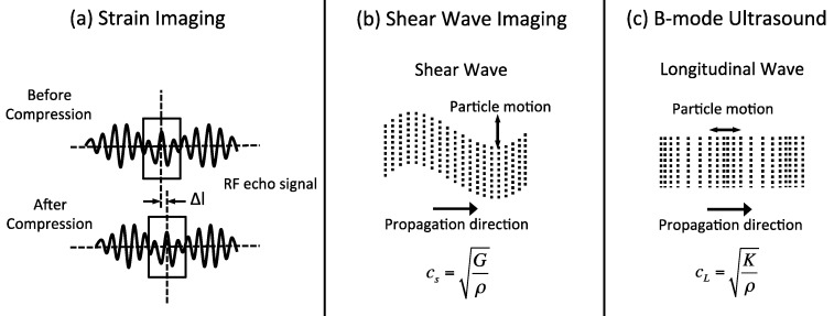 Сравнение методов эластографии: strain vs shear-wave